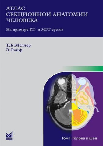 Атлас секційної анатомії людини на прикладі КТ - і МРТ - зрізів в 3-х томах. Том 1. Голова і шия - фото 1
