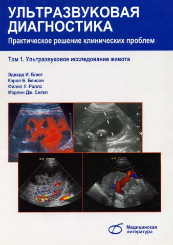 Ультразвукова діагностика. Практичне вирішення клінічних проблем. В 5 томах. Том 1. Ультразвукове дослідження живота - фото 1