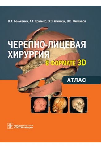 Черепно-лицева хірургія у форматі 3D: атлас - фото 1