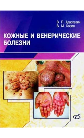Шкірні та венеричні хвороби 2-е изд. - фото 1
