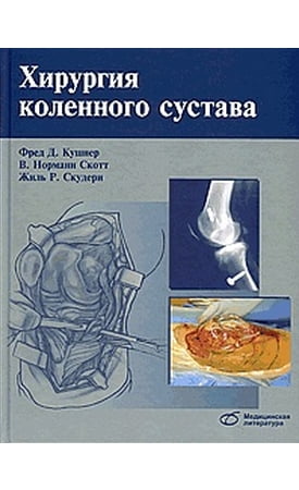 Хирургия коленного сустава - фото 1