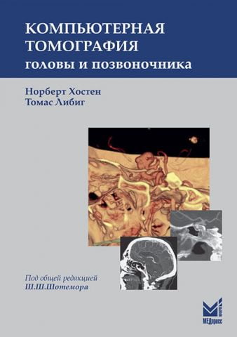 Компютерна томографія голови і хребта 2-е изд. - фото 1