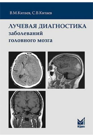 Променева діагностика захворювань головного мозку - фото 1