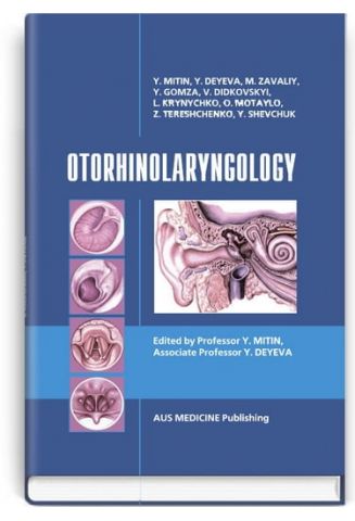 Otorhynolaryngology = Оториноларингологія: підручник (ВНЗ ІV р. а.) / за ред. Ю. Ф. Мітіна, Ю. В. Дєєвої. — 3-тє вид., переробл. та допов. - фото 1