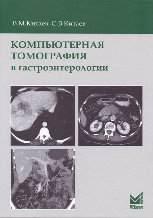Компьютерная томография в гастроэнтерологии. 2-е изд - фото 1