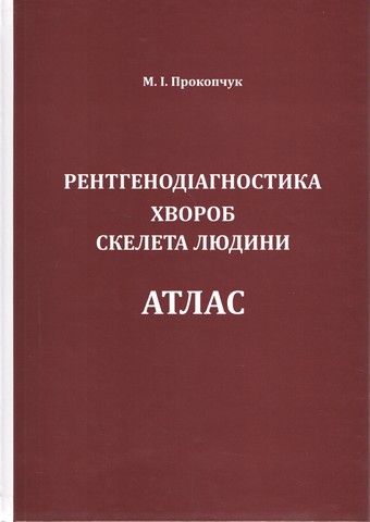 Рентгенодіагностика хвороб скелета людини