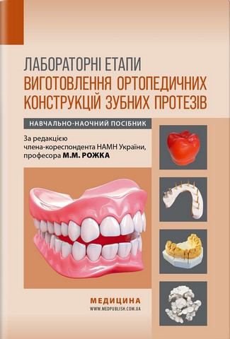 Лабораторні етапи виготовлення ортопедичних конструкцій...