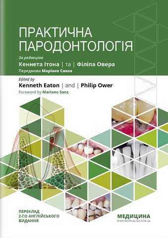 Практична пародонтологія: 2-е видання. Кеннет Ітон, Філіп Овер - фото 1