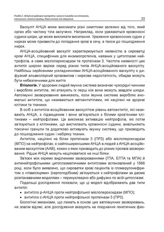 АНЦА-асоційовані васкуліти. Катеренчук І.П., Гуцаленко O.O., Ярмола T.І. - фото 8