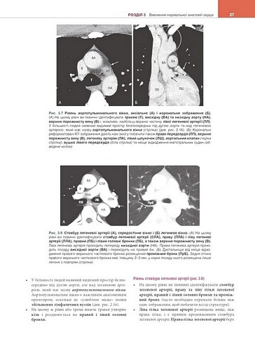 Вивчення радіології. Основи візуалізації. 5-е видання - фото 6