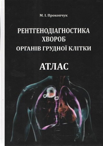 Рентгенодіагностика хвороб органів грудної клітки....