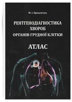 Рентгенодіагностика хвороб органів грудної клітки. Атлас - УЗИ, Рентген, Томография