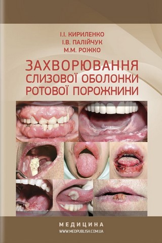 Захворювання слизової оболонки ротової порожнини. Навчальний...