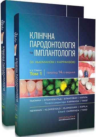 Клінічна пародонтологія та імплантологія за Ньюманом...