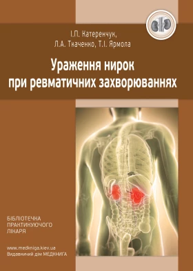 Ураження нирок при ревматичних захворюваннях