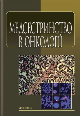 Медсестринство в онкології: підручник (ЗНЗ І—ІІІ н. а.) / Л. М. Ковальчук, О. М. Парійчук, І.І. Романишин та ін.; за ред. К. М. Ковальчука. — 2-е вид., випр. - Онкология
